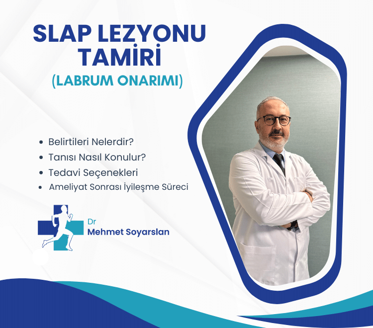 Labrum Onarimi