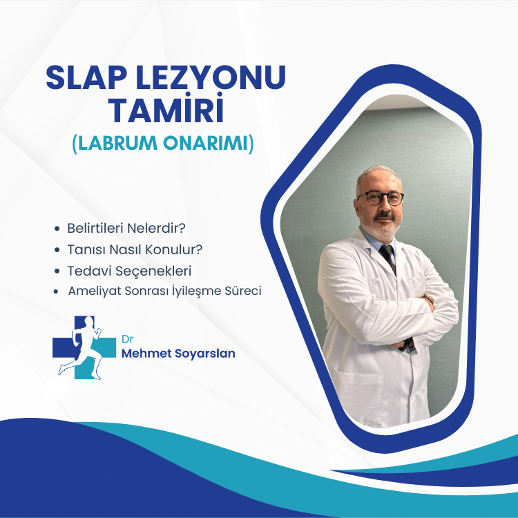 SLAP Lezyonu Tamiri (Labrum Onarımı) 2 Labrum Onarimi