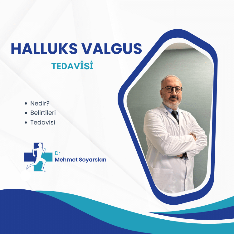 halluks valgus tedavisi