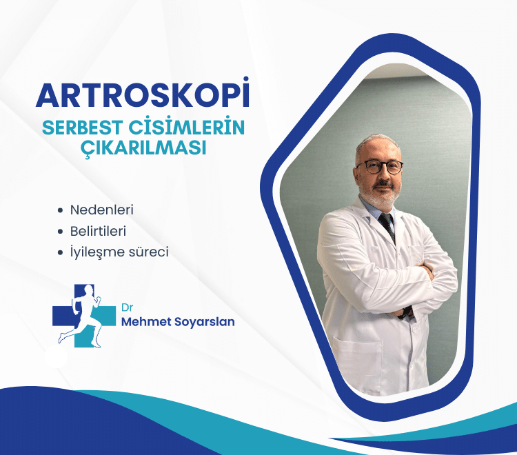 serbest cisimlerin cikarilmasi