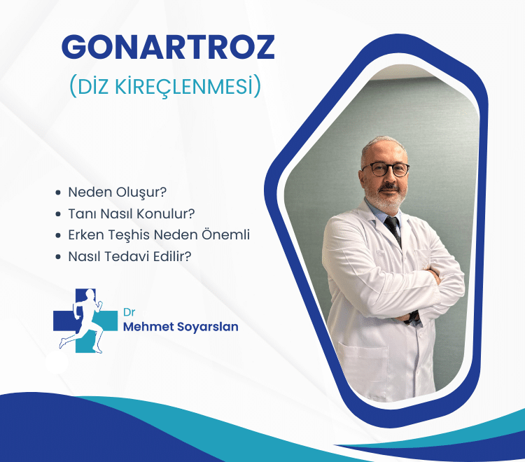 Gonartroz (Diz Kireçlenmesi) Nedir? Belirtileri, Nedenleri ve Tedavi Yöntemleri 6 diz kireclenmesi