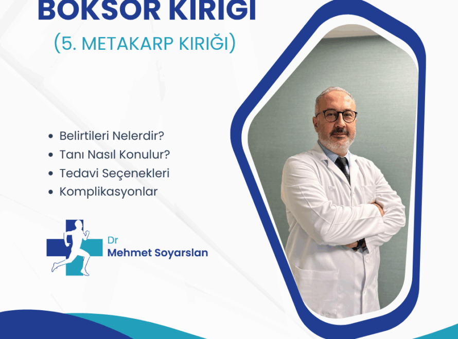 Boksor Kirigi