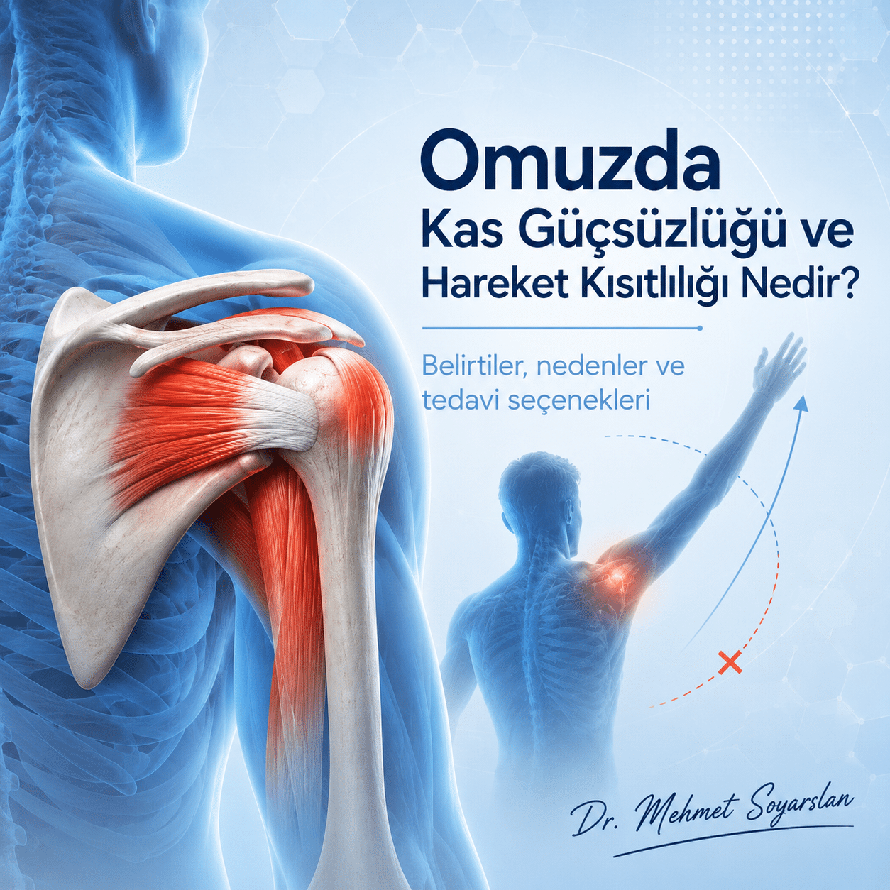 Omuzda Kas Güçsüzlüğü Neden Olur? Hareket Kısıtlılığı Belirtileri ve Tedavisi 2 omuz kas yirtiklari